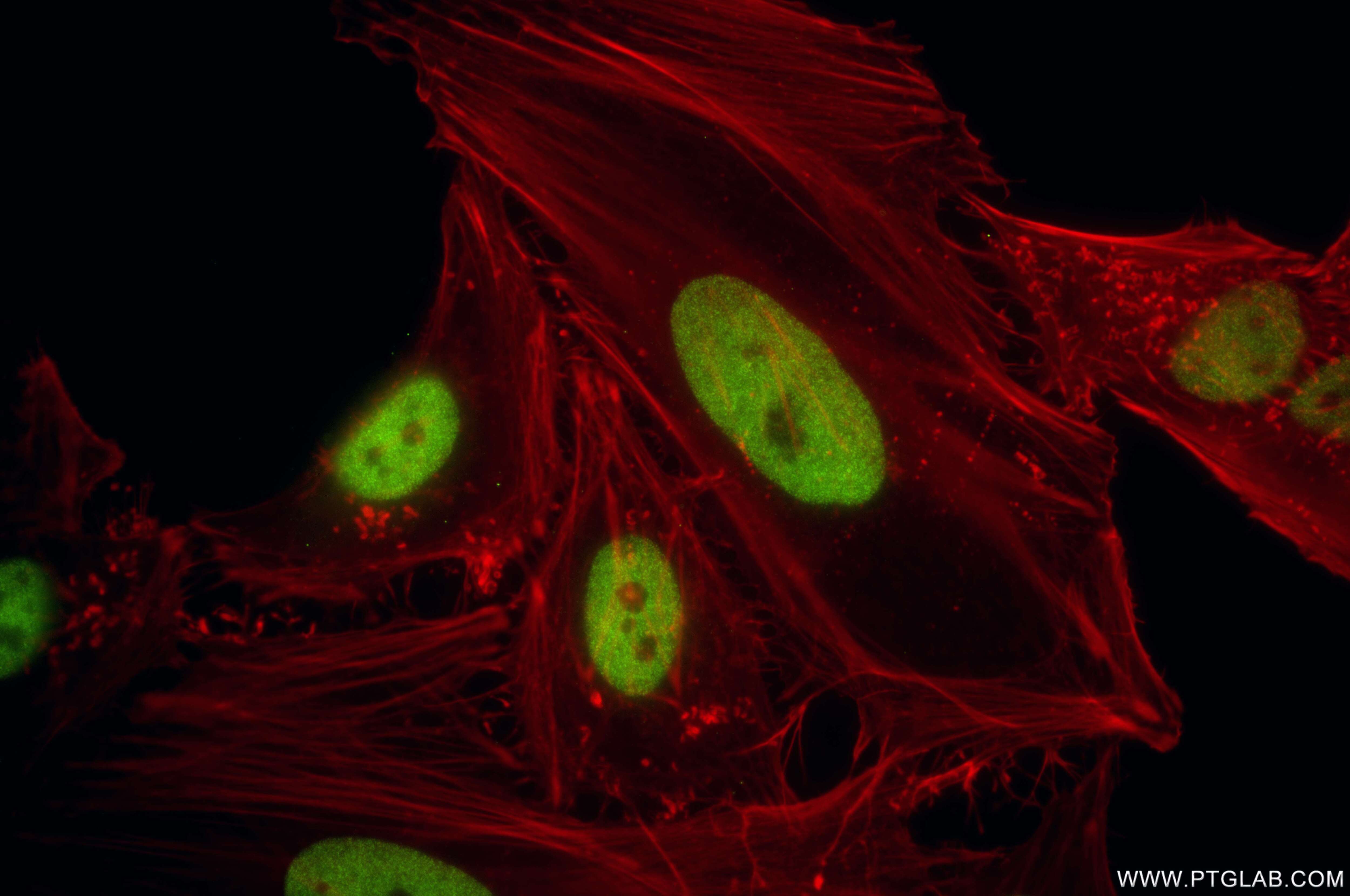 Immunofluorescence (IF) / fluorescent staining of HeLa cells using CHD8 Recombinant antibody (86032-1-RR)