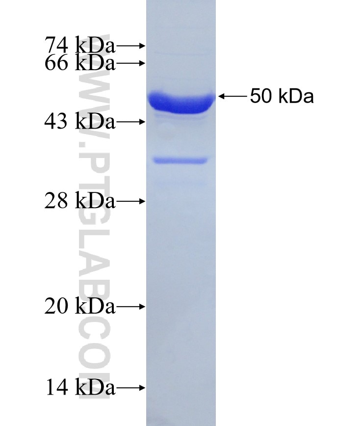 CHD8 fusion protein Ag31425 SDS-PAGE