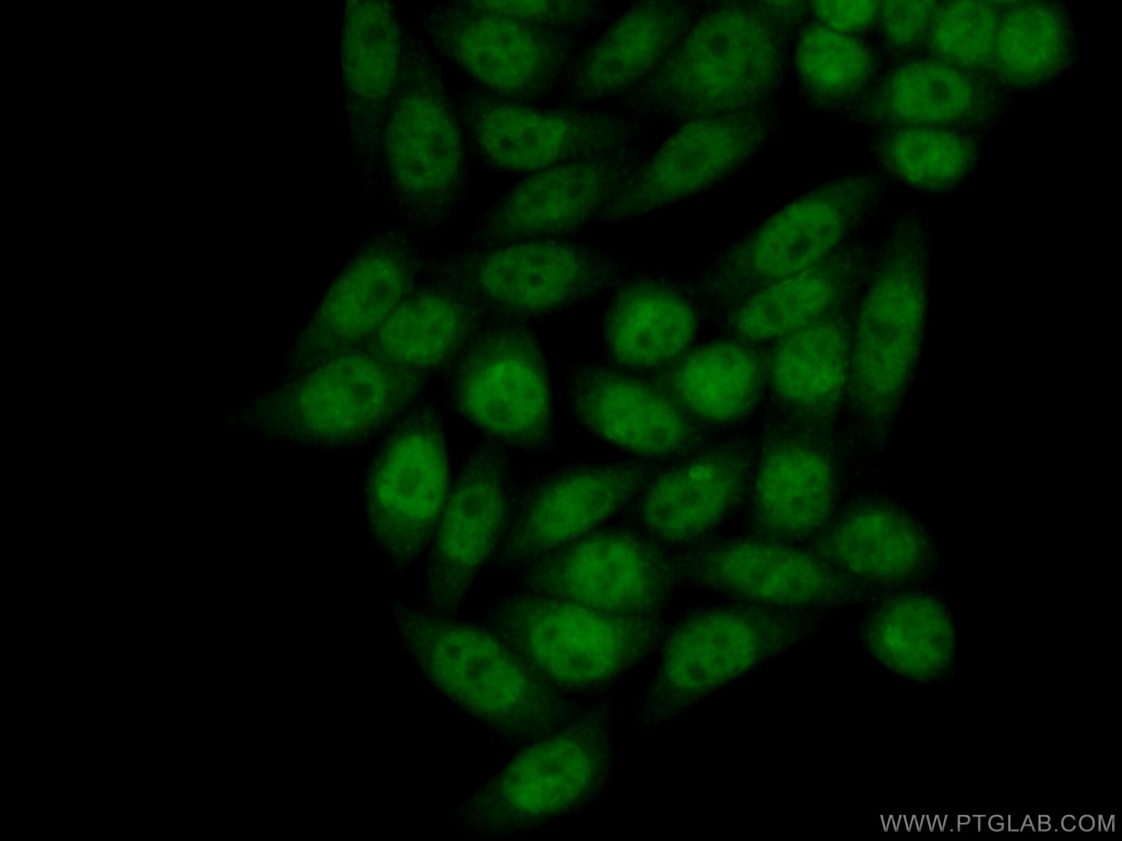 Immunofluorescence (IF) / fluorescent staining of HeLa cells using CHD9 Polyclonal antibody (13402-1-AP)