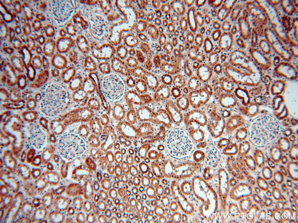 Immunohistochemistry (IHC) staining of human kidney tissue using CHD9 Polyclonal antibody (13402-1-AP)