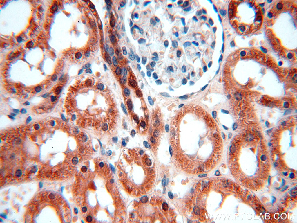 Immunohistochemistry (IHC) staining of human kidney tissue using CHD9 Polyclonal antibody (13402-1-AP)