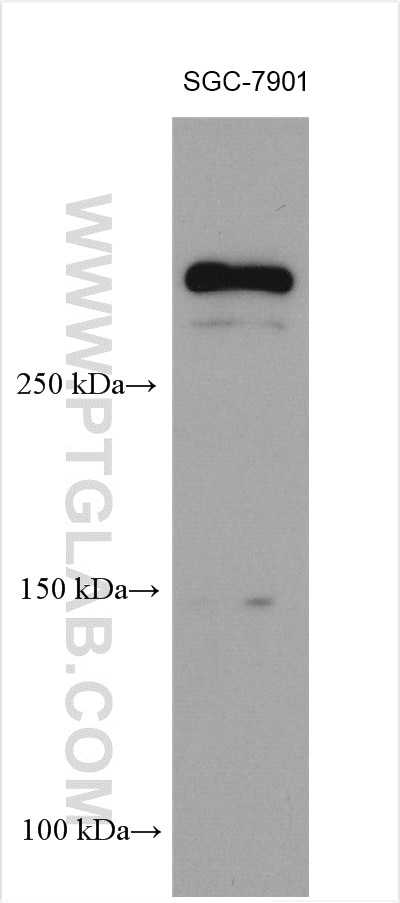 WB analysis using 13402-1-AP