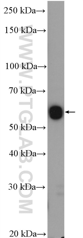 Western Blot (WB) analysis of mouse kidney tissue using CHDH Polyclonal antibody (17356-1-AP)