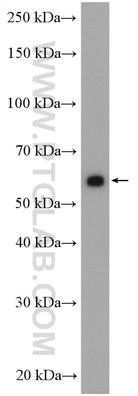 Western Blot (WB) analysis of mouse kidney tissue using CHDH Polyclonal antibody (17356-1-AP)