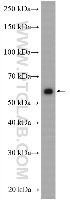 Western Blot (WB) analysis of mouse kidney tissue using CHDH Polyclonal antibody (17356-1-AP)