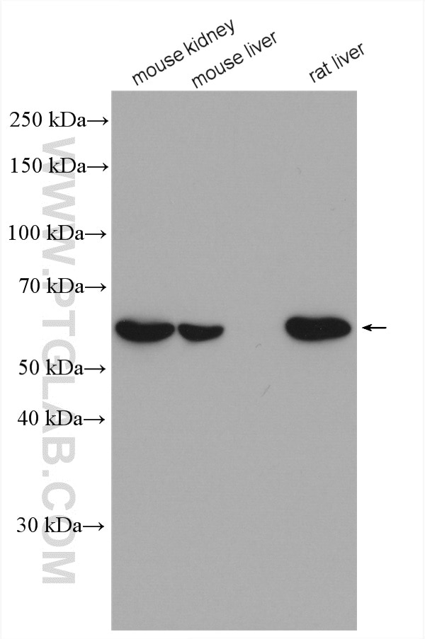 Western Blot (WB) analysis of various lysates using CHDH Polyclonal antibody (17356-1-AP)