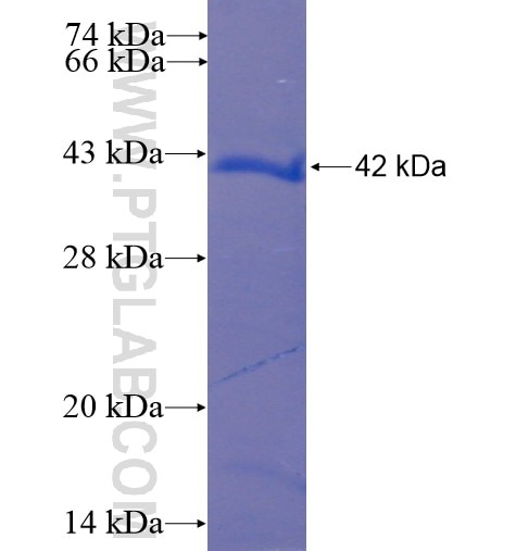 CHDH fusion protein Ag10614 SDS-PAGE