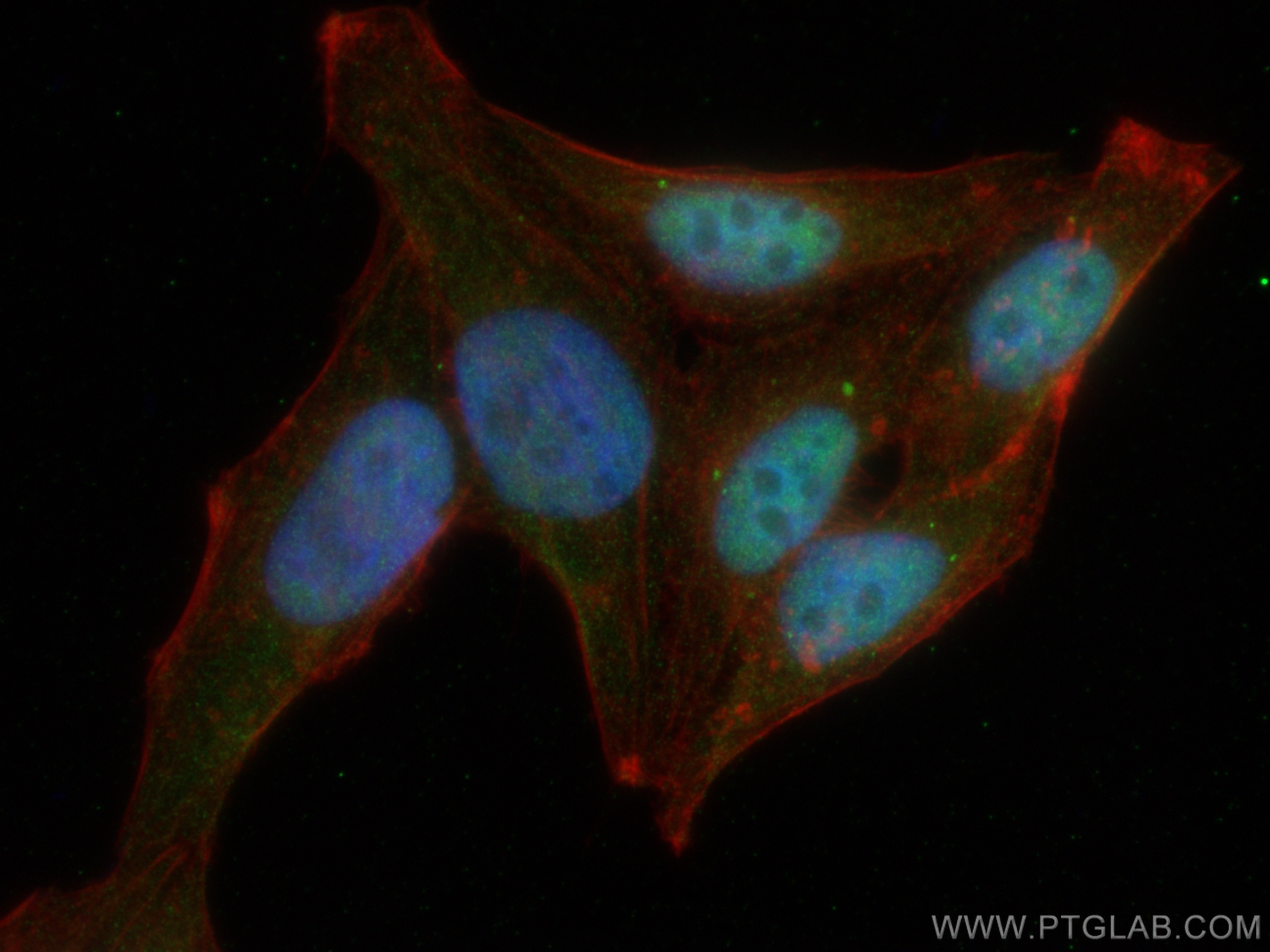 Immunofluorescence (IF) / fluorescent staining of HepG2 cells using CHEK2 Polyclonal antibody (13954-1-AP)