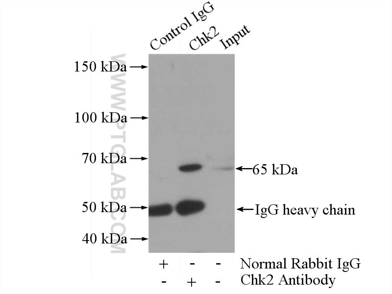 CHEK2 Polyclonal antibody