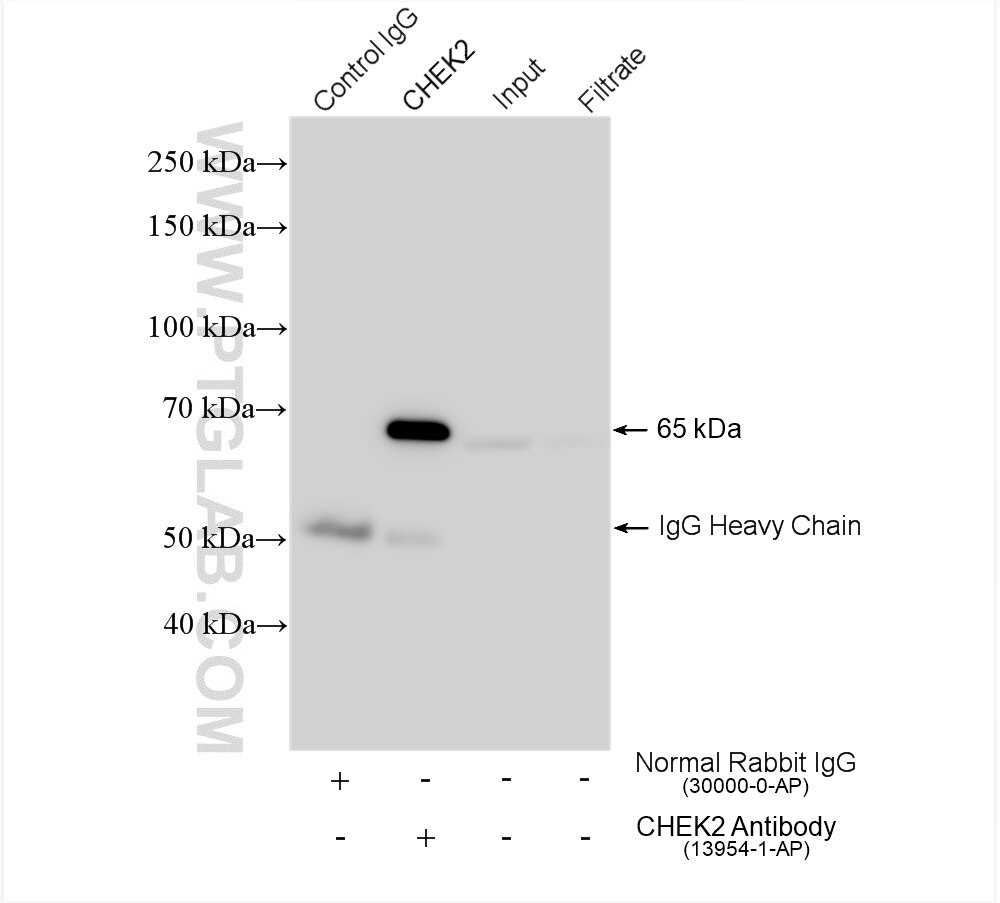 Immunoprecipitation (IP) experiment of HeLa cells using CHEK2 Polyclonal antibody (13954-1-AP)