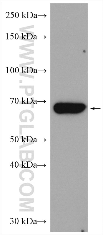 Western Blot (WB) analysis of HL-60 cells using CHEK2 Polyclonal antibody (13954-1-AP)