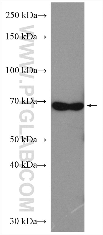 Western Blot (WB) analysis of HeLa cells using CHEK2 Polyclonal antibody (13954-1-AP)