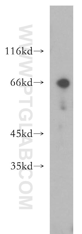 Western Blot (WB) analysis of HL-60 cells using CHEK2 Polyclonal antibody (13954-1-AP)