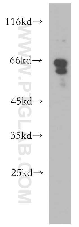 CHEK2 Polyclonal antibody