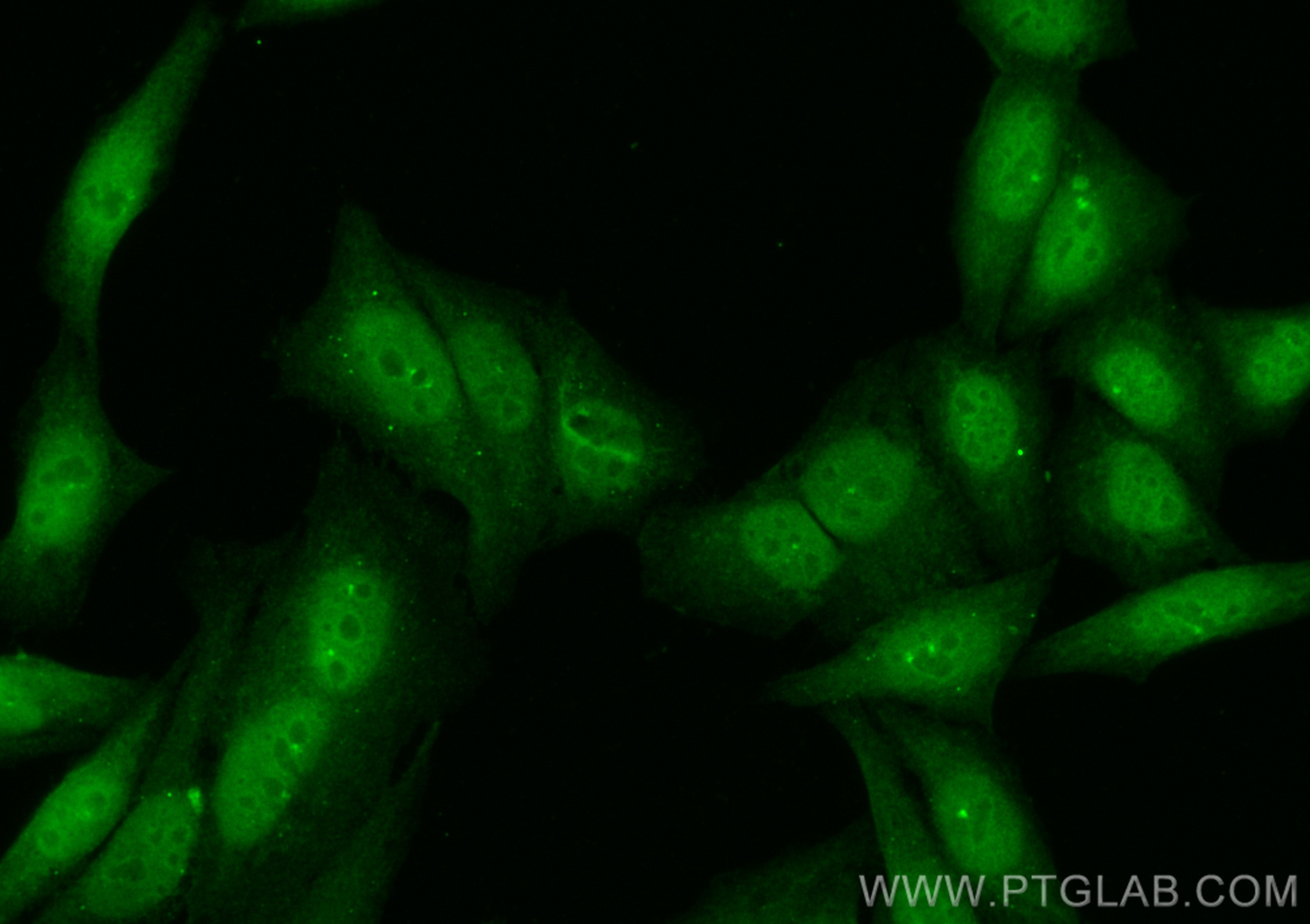 Immunofluorescence (IF) / fluorescent staining of HepG2 cells using CoraLite® Plus 488-conjugated CHEK2 Polyclonal ant (CL488-13954)