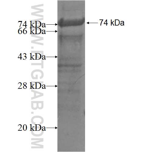 CHEK2 fusion protein Ag5065 SDS-PAGE