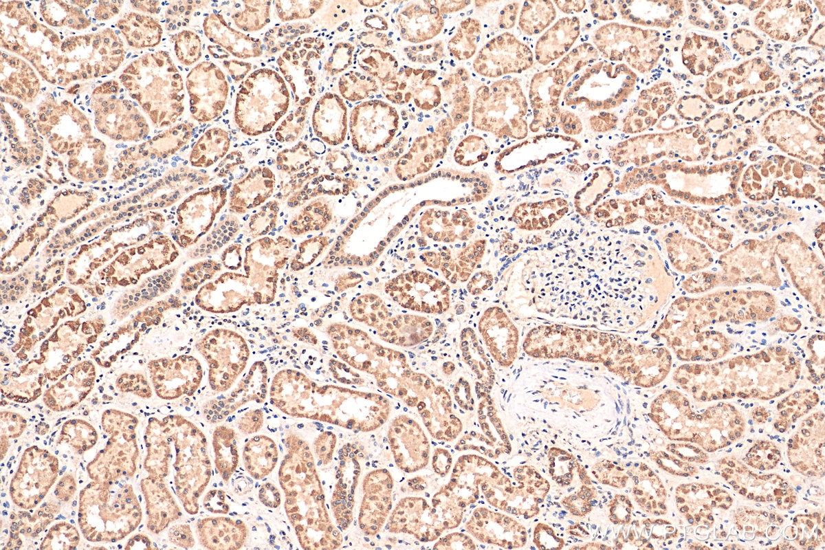 Immunohistochemistry (IHC) staining of human kidney tissue using CHERP Polyclonal antibody (25389-1-AP)