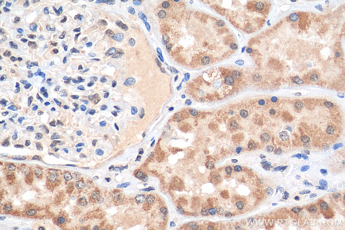 Immunohistochemistry (IHC) staining of human kidney tissue using CHERP Polyclonal antibody (25389-1-AP)