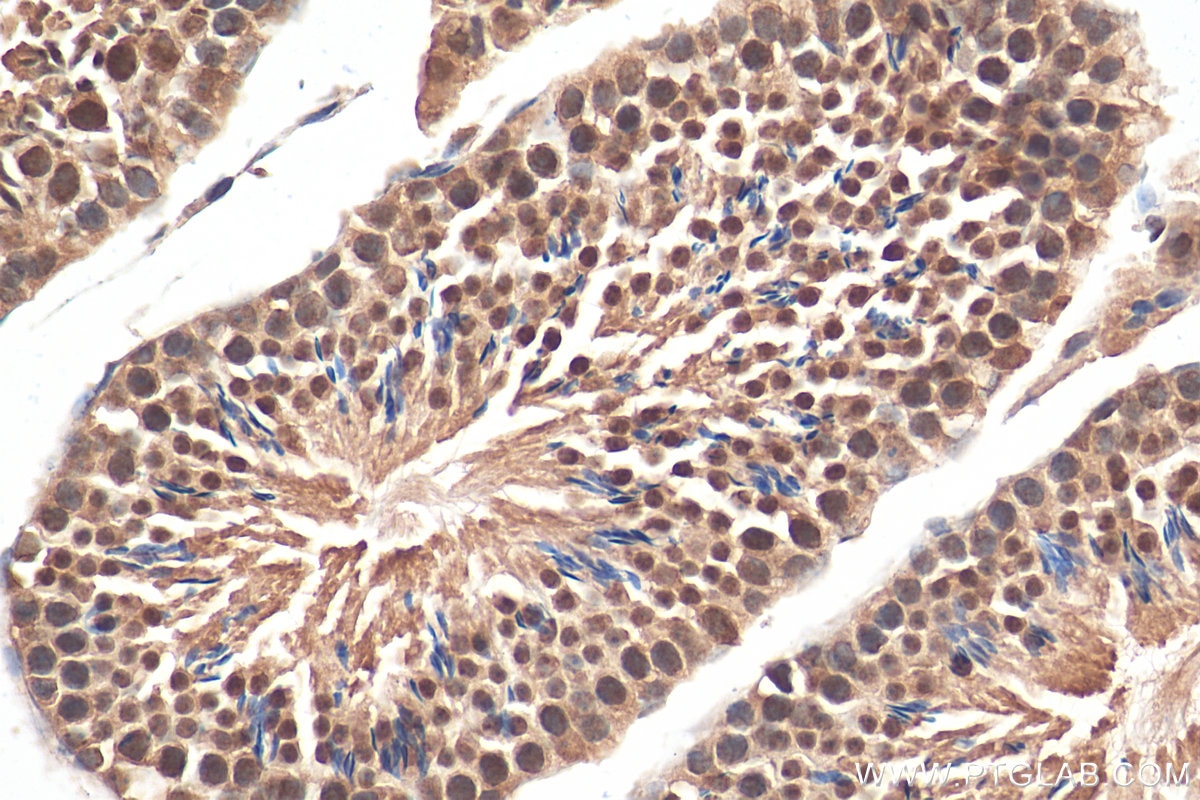 Immunohistochemistry (IHC) staining of mouse testis tissue using CHERP Polyclonal antibody (25389-1-AP)
