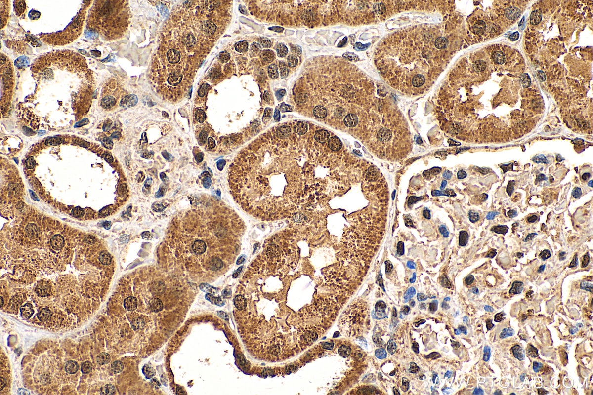 Immunohistochemistry (IHC) staining of human kidney tissue using CHERP Polyclonal antibody (25389-1-AP)