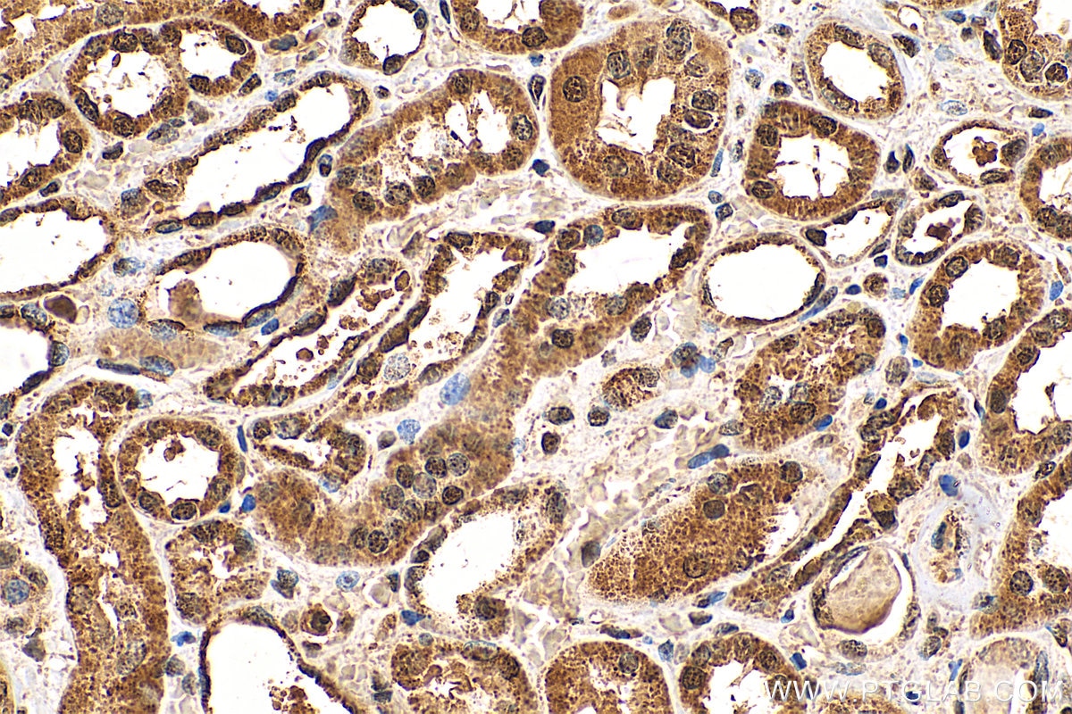 Immunohistochemistry (IHC) staining of human kidney tissue using CHERP Polyclonal antibody (25389-1-AP)