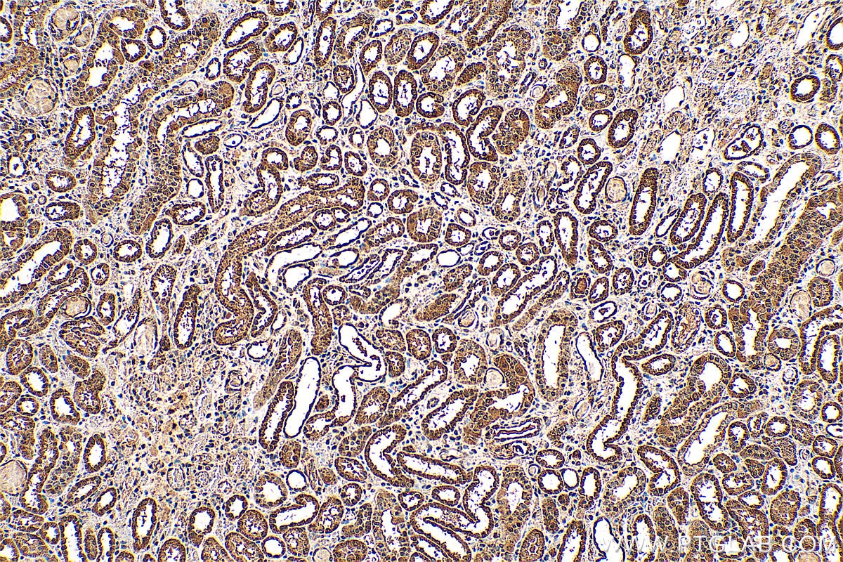 IHC staining of human kidney using 25389-1-AP