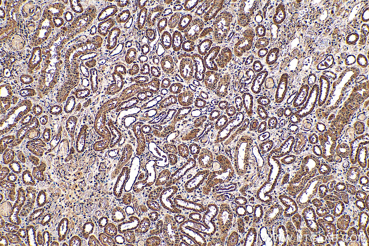 Immunohistochemistry (IHC) staining of human kidney tissue using CHERP Polyclonal antibody (25389-1-AP)