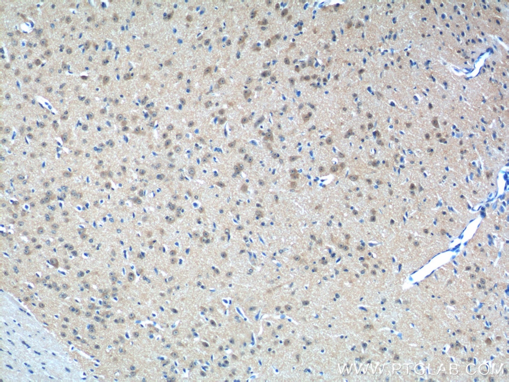 Immunohistochemistry (IHC) staining of mouse brain tissue using CHERP Polyclonal antibody (25389-1-AP)