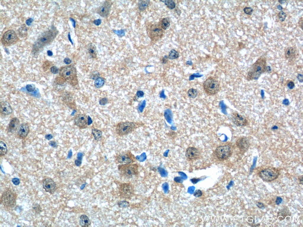 Immunohistochemistry (IHC) staining of mouse brain tissue using CHERP Polyclonal antibody (25389-1-AP)