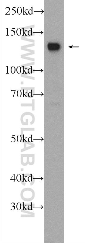 Western Blot (WB) analysis of Jurkat cells using CHERP Polyclonal antibody (25389-1-AP)