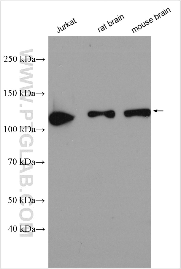 Western Blot (WB) analysis of various lysates using CHERP Polyclonal antibody (25389-1-AP)