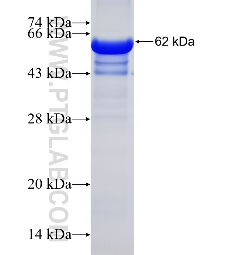 CHERP fusion protein Ag13428 SDS-PAGE