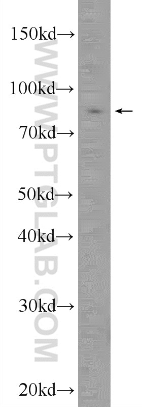 Western Blot (WB) analysis of SMMC-7721 cells using CHFR Polyclonal antibody (12169-1-AP)