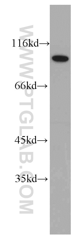 Western Blot (WB) analysis of Jurkat cells using CHFR Polyclonal antibody (12169-1-AP)