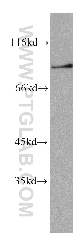 Western Blot (WB) analysis of mouse brain tissue using CHFR Polyclonal antibody (12169-1-AP)