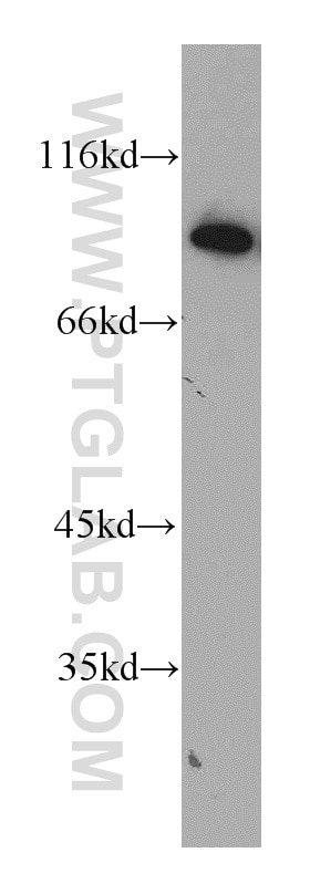 Western Blot (WB) analysis of A549 cells using CHFR Polyclonal antibody (12169-1-AP)