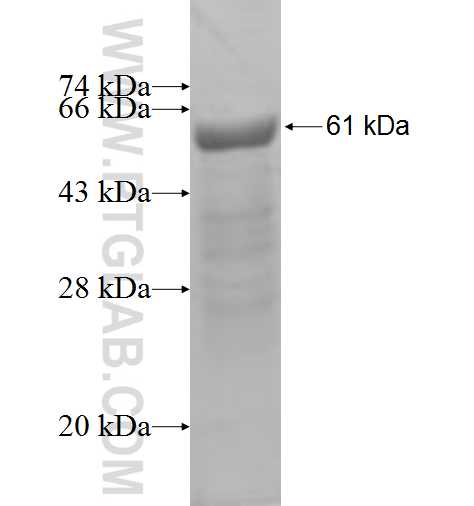 CHFR fusion protein Ag2811 SDS-PAGE