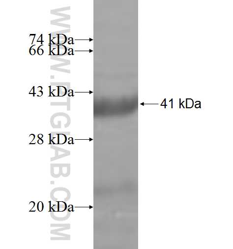 CHFR fusion protein Ag6557 SDS-PAGE
