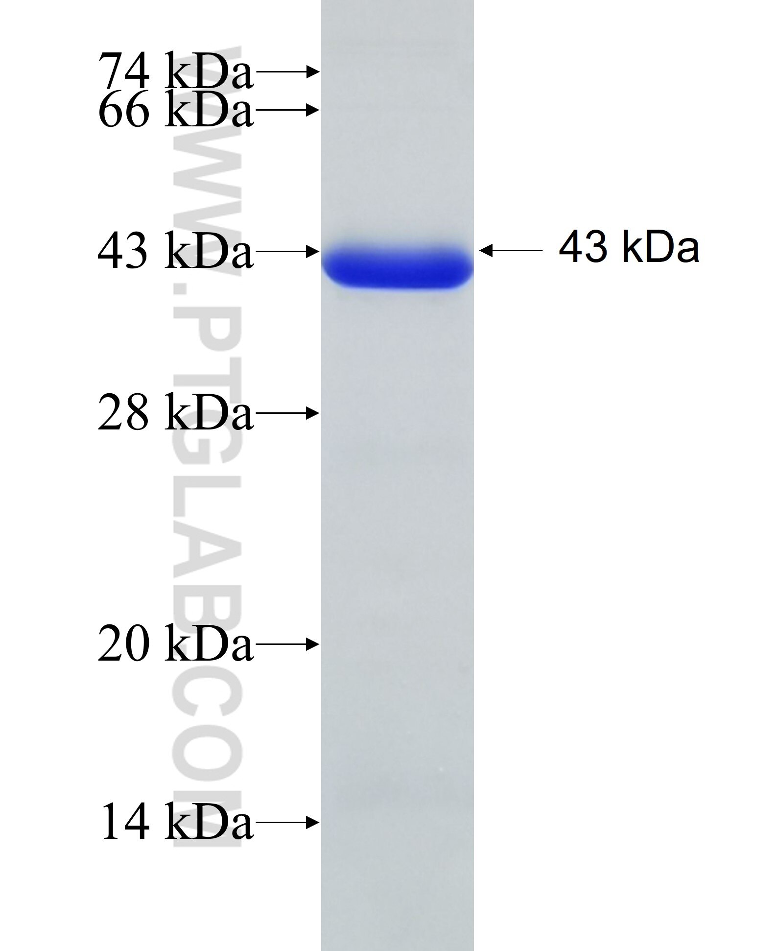 CHFR fusion protein Ag6557 SDS-PAGE