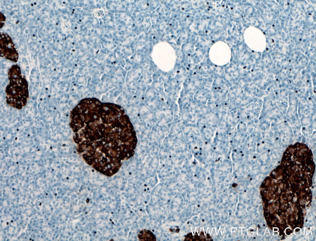 Immunohistochemistry (IHC) staining of human pancreas tissue using Chromogranin A Polyclonal antibody (10529-1-AP)