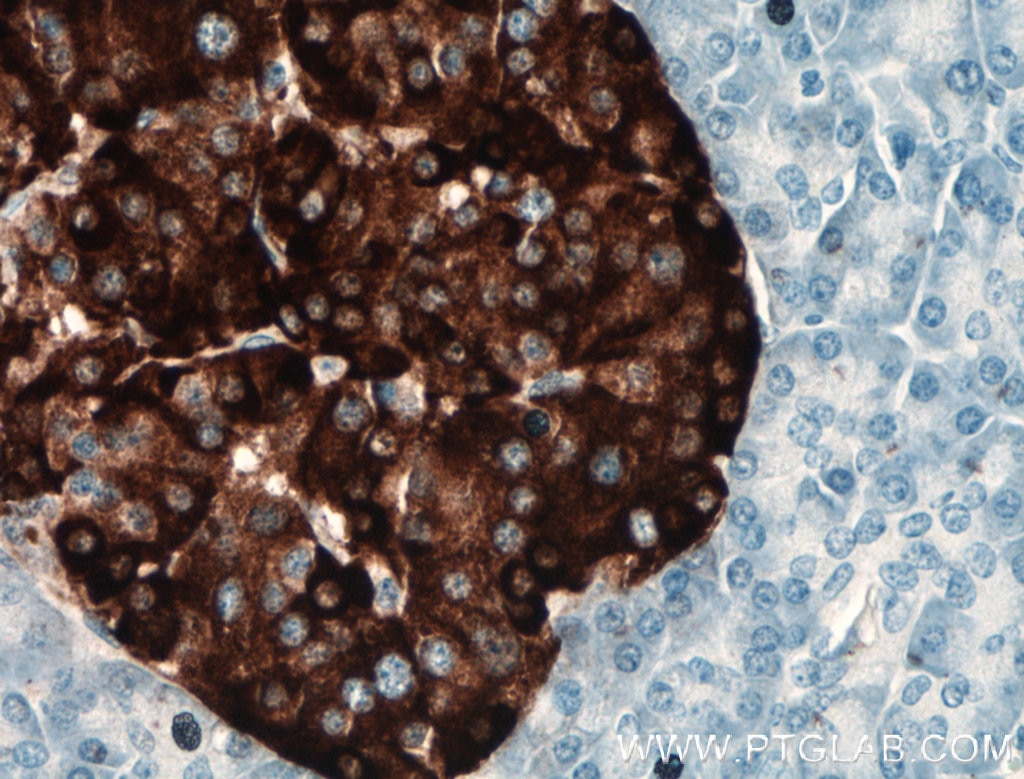 Immunohistochemistry (IHC) staining of human pancreas tissue using Chromogranin A Polyclonal antibody (10529-1-AP)