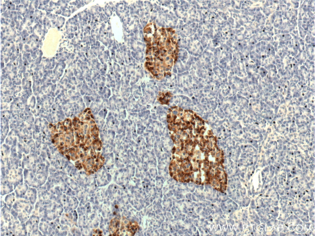 Immunohistochemistry (IHC) staining of human pancreas tissue using Chromogranin A Polyclonal antibody (10529-1-AP)