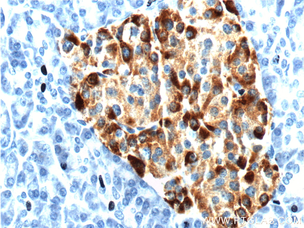 Immunohistochemistry (IHC) staining of human pancreas tissue using Chromogranin A Polyclonal antibody (10529-1-AP)