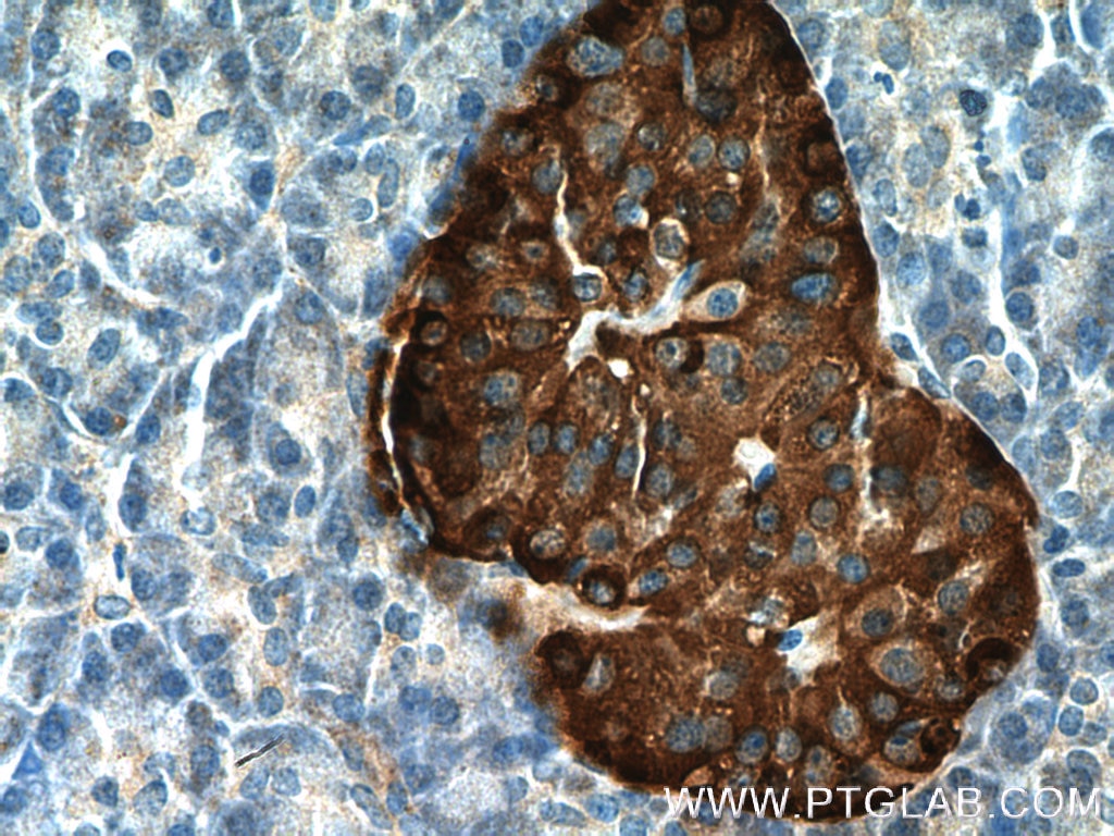 Immunohistochemistry (IHC) staining of human pancreas tissue using Chromogranin A Polyclonal antibody (10529-1-AP)