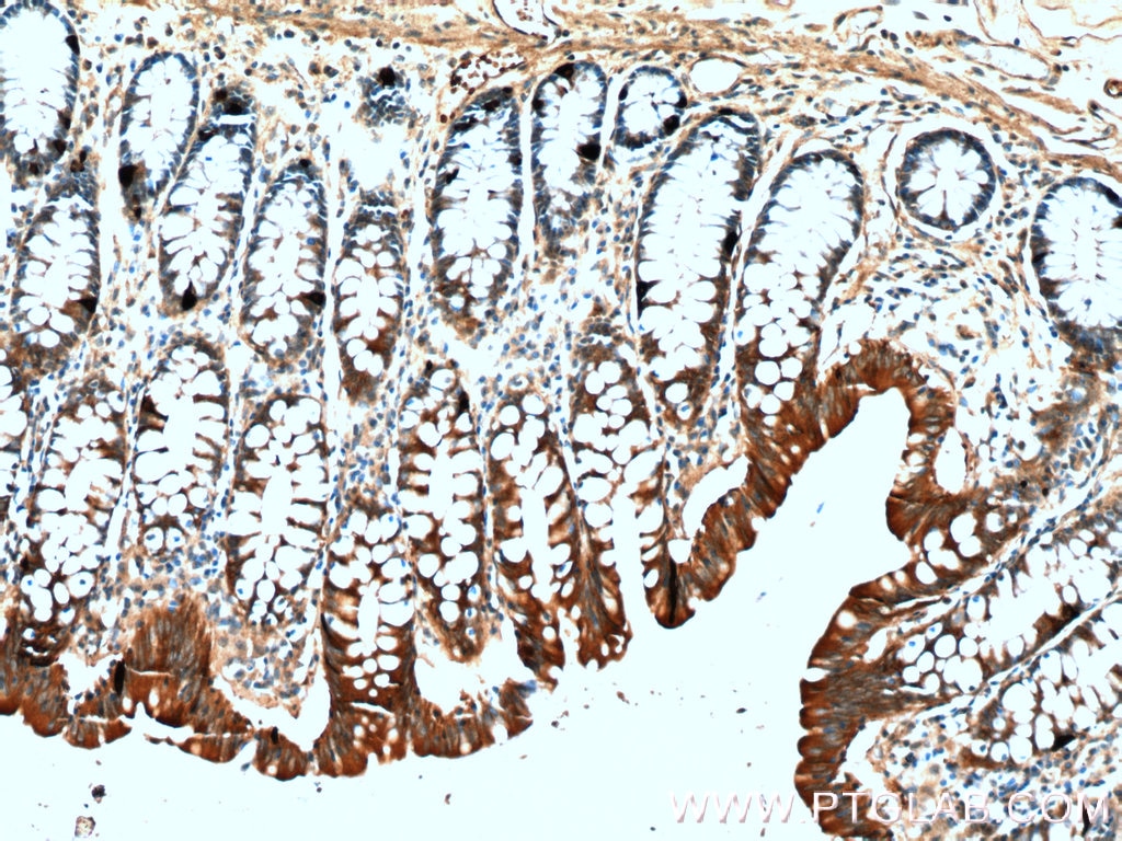 Immunohistochemistry (IHC) staining of human colon tissue using Chromogranin A Polyclonal antibody (10529-1-AP)
