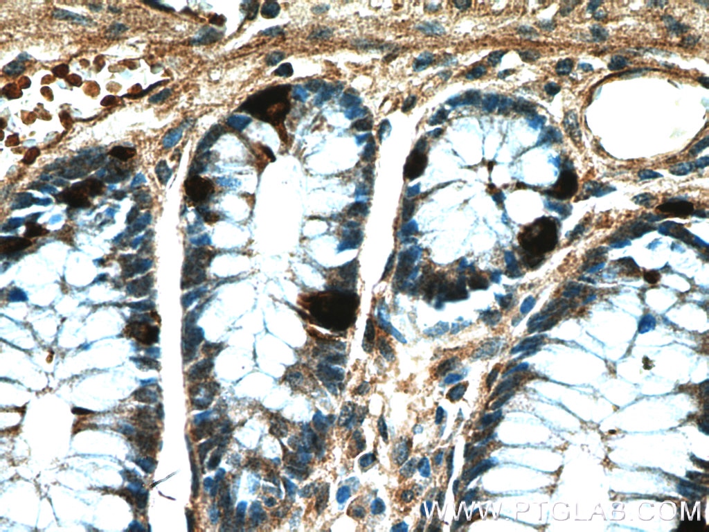 IHC staining of human colon using 10529-1-AP