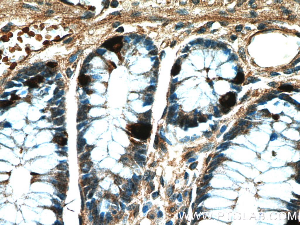 Immunohistochemistry (IHC) staining of human colon tissue using Chromogranin A Polyclonal antibody (10529-1-AP)