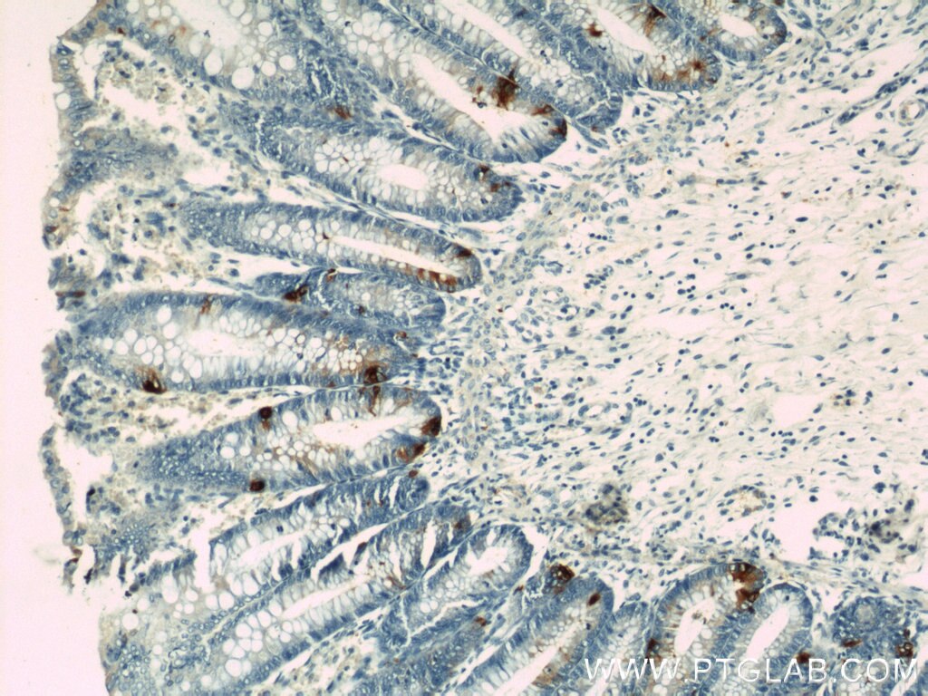 Immunohistochemistry (IHC) staining of human colon tissue using Chromogranin A Polyclonal antibody (10529-1-AP)