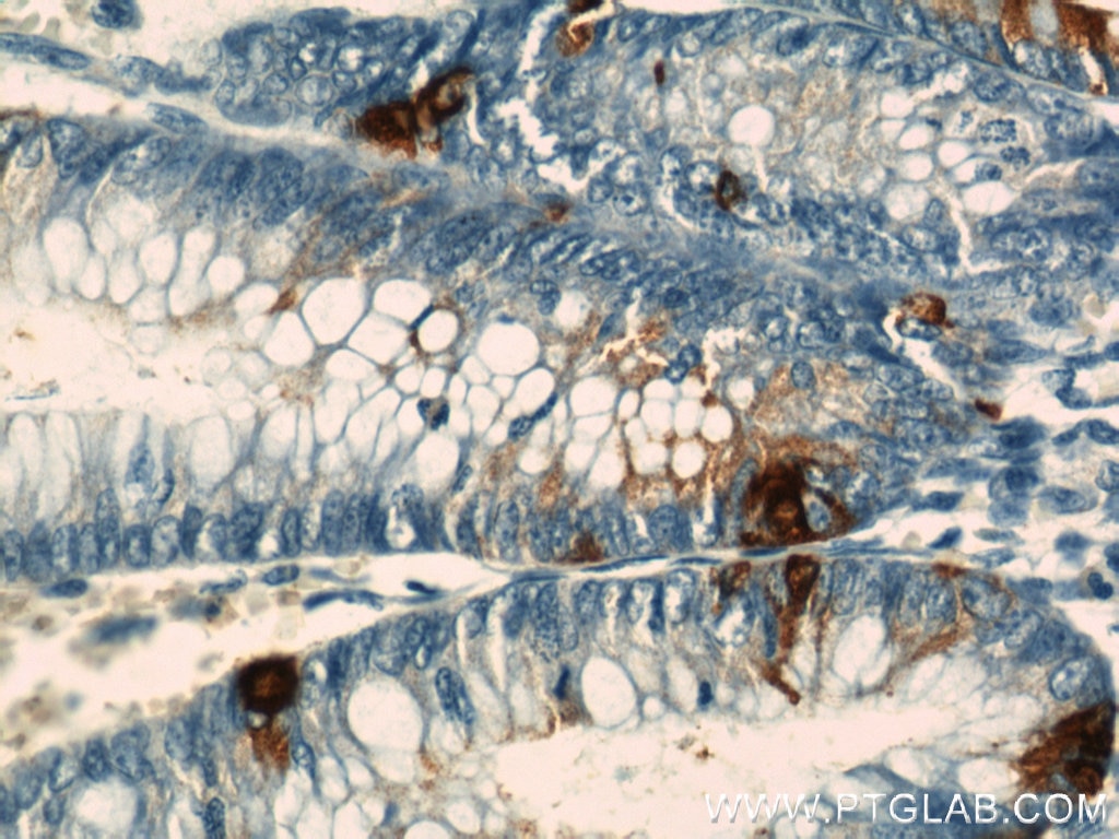 IHC staining of human colon using 10529-1-AP