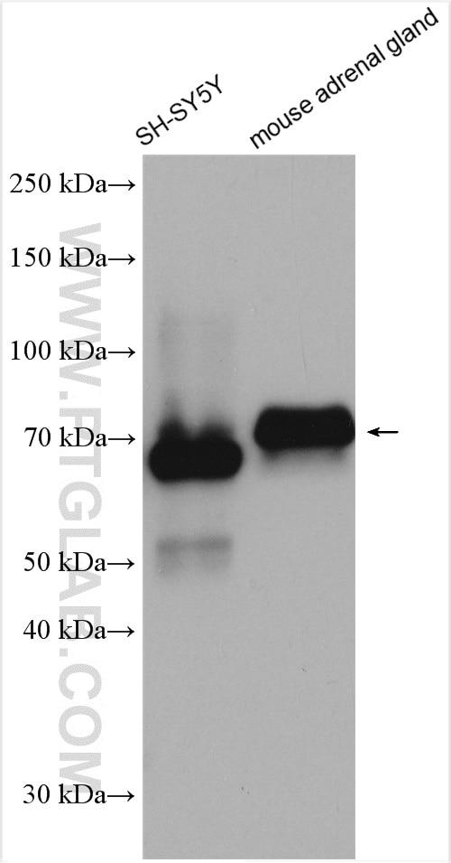 Western Blot (WB) analysis of various lysates using Chromogranin A Polyclonal antibody (10529-1-AP)